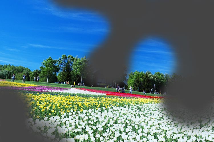 緑内障のイメージ写真