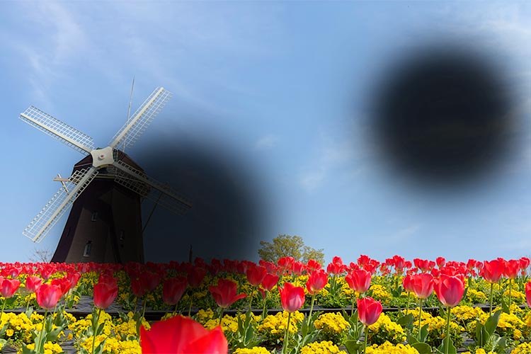 網膜静脈閉塞症のイメージ写真