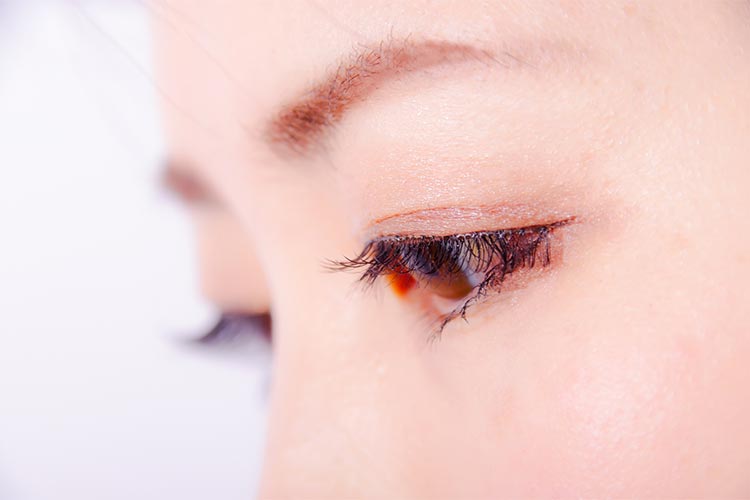 瞼が腫れるイメージ写真