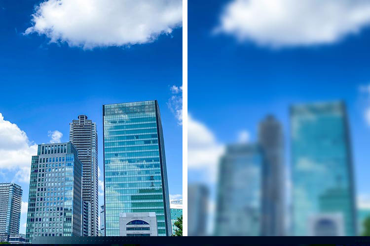 ぶどう膜炎のイメージ写真